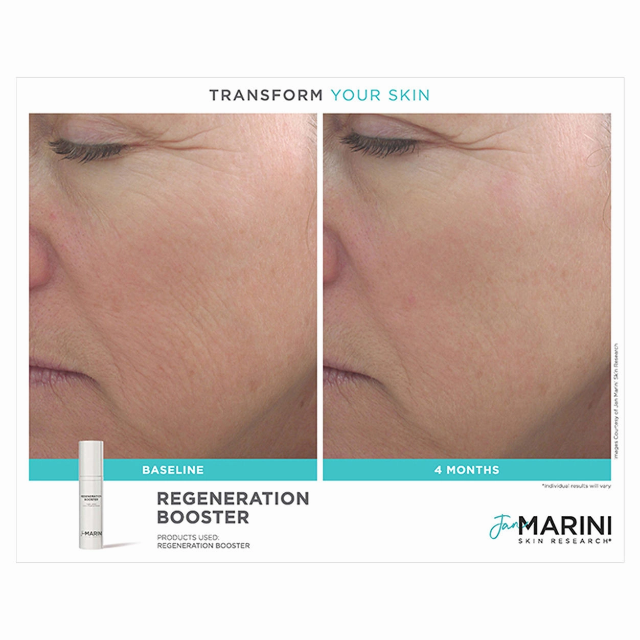 Age Intervention Regeneration Booster